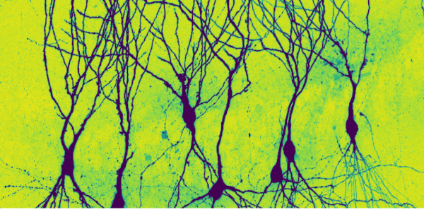 grün-blaues Bild von neuronalen Netzwerken unterm Mikroskop